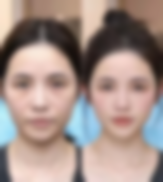 四、郑州佑尔美整形美容开展的主要项目和特色项目: