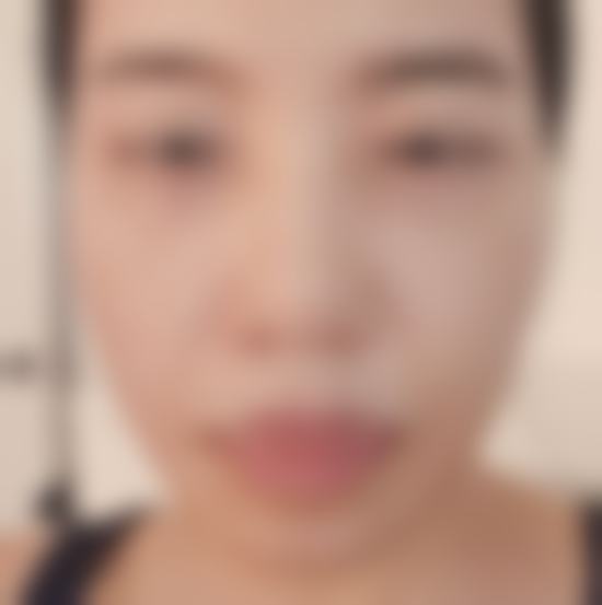 韩国TS整形医院梁涼弼联系方式在哪找？毕业名校经验丰富，多领域整形技艺佳 
