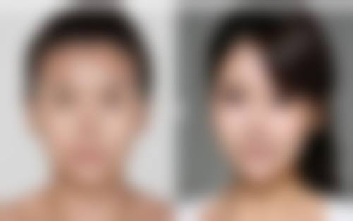 揭秘吸脂肪的术中操作:多种术式大显身手