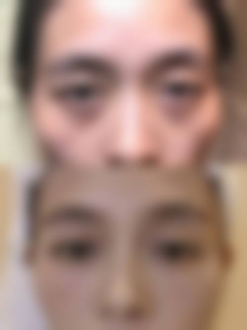 四、台州温岭医美佳医疗美容诊所实例