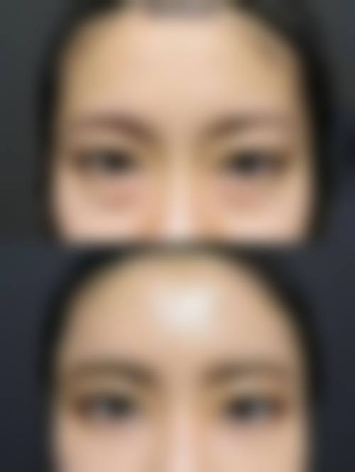 七、台州温岭医美佳医疗美容诊所真实的顾客评价如下: