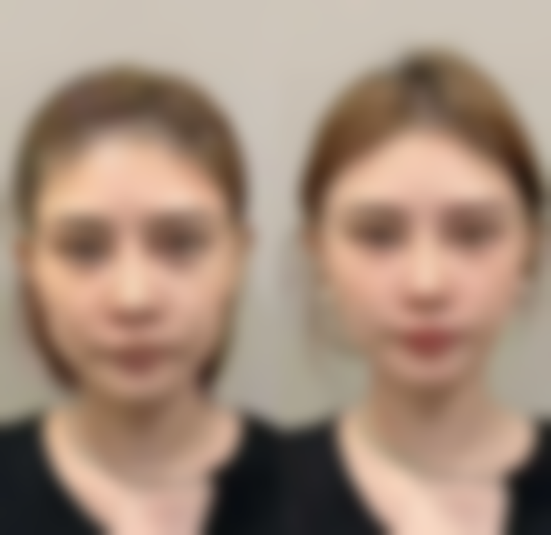 四、丹阳微美桃花源整形医院开展的主要项目和特色项目: