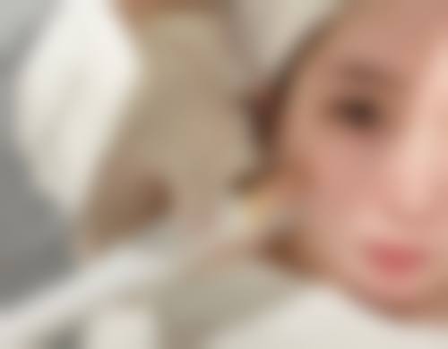 疤痕疙瘩化脓治愈之其他治疗方式