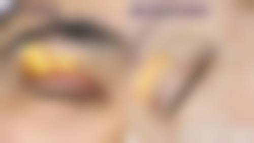 八、武汉欣美荟医疗美容医院真实的顾客评价如下：