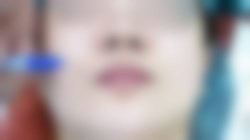 周冉医生在哪家医院怎么预约?