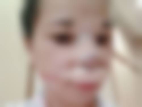 想摆脱眼袋困扰？生活调理、医美手术等多途径，为你打造明亮双眸 
