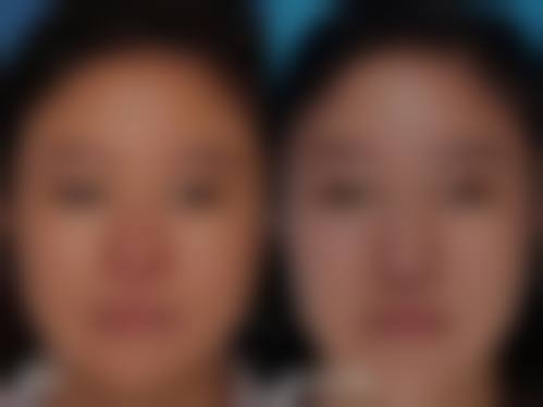 七、温岭走运元素整形医院真实的顾客评价如下: