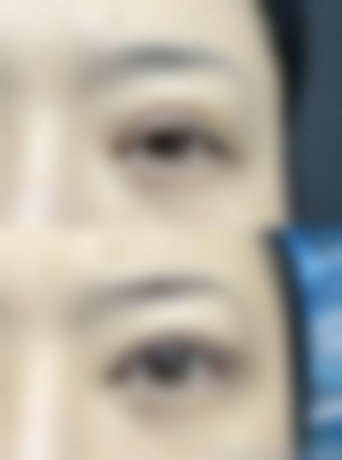 五、郑州美那多整形医院实例