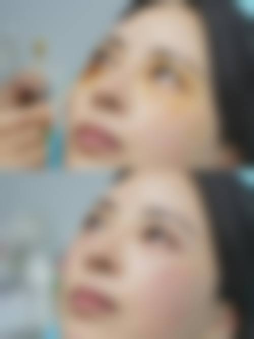 八、韩国眼角整形外科医院真实的顾客评价如下: