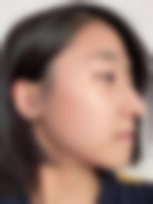 五、佛山宝之丽医疗美容门诊部实例