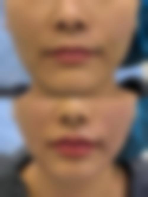 二、昆明聚美汇医疗美容诊所正规吗?来看看医院资质: