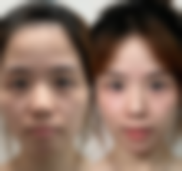 八、昆明聚美汇医疗美容诊所真实的顾客评价如下: