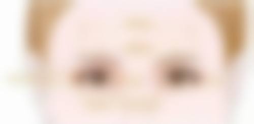 面部吸脂成效显著,1 - 3个月让你拥有精致脸蛋