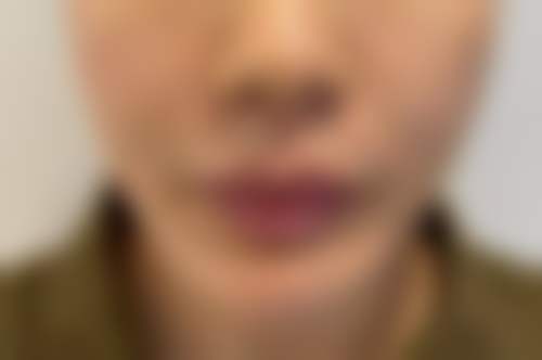 六、成都星宏晶肤医疗美容诊所怎么预约：