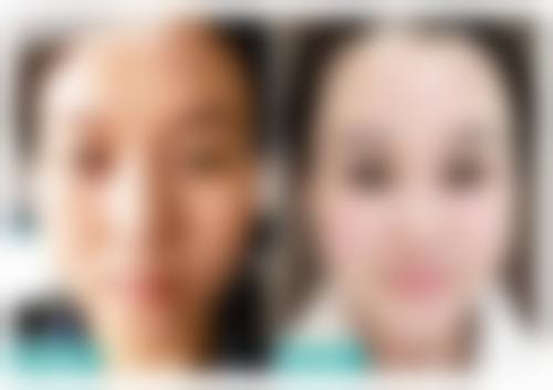 七、武汉同和皮肤病专科整形医院真实的顾客评价如下：