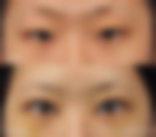 五、西安医学校第二附属医院医疗美容科实例