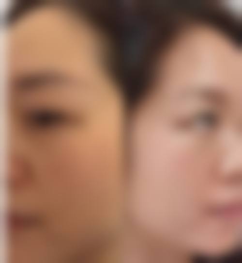 七、榆林市第一医院烧伤整形与皮肤外科价格表：（仅供参考）