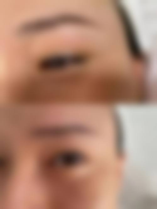 五、长沙叶子医疗美容医院实例