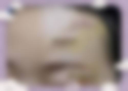 三、长沙叶子医疗美容医院医生介绍: