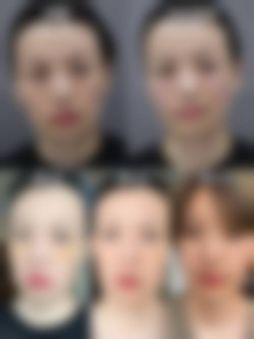 五、东方悦她婕熹卡整形医院怎么预约: