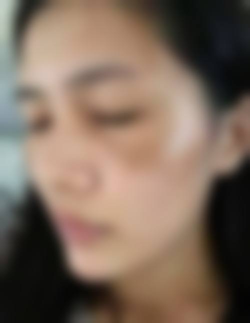 五、南京中天皮肤病医院医疗美容科实例