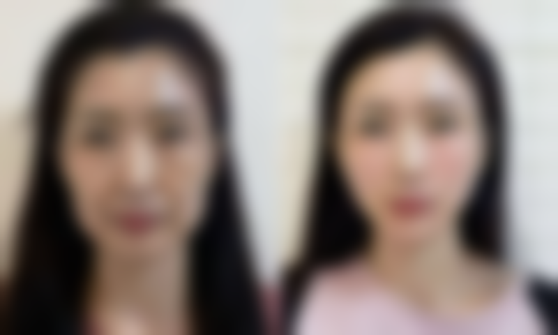 四、TCBSkinClinic实例