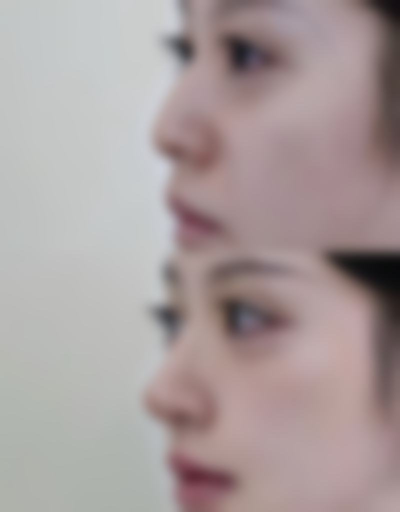 七、东方悦她婕熹卡整形医院真实的顾客评价如下: