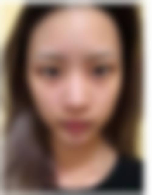 七、淮南美橙医疗整形美容医院真实的顾客评价如下: