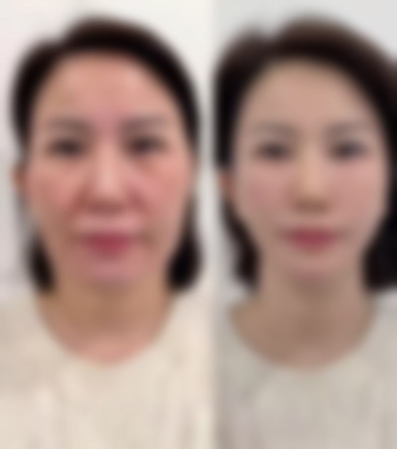 七、韩国清潭Park皮肤科真实的顾客评价如下：