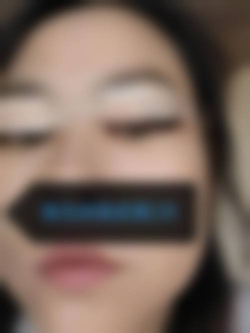 七、锦州维纳斯整形美容医院价格表：（仅供参考）