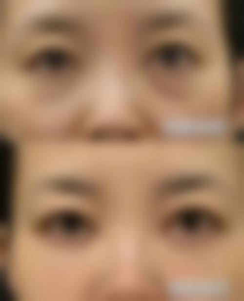 八、北京美人鱼整形医疗美容门诊部真实的顾客评价如下: