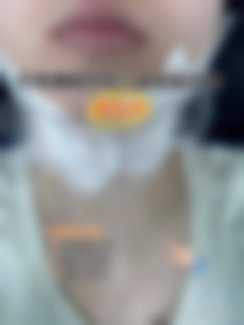 七、鄂州逆时光整形医疗美容医院真实的顾客评价如下: