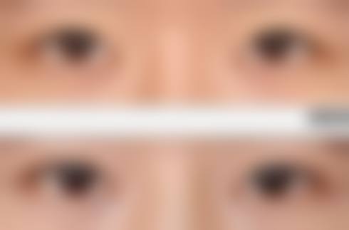 五、锦州维纳斯整形美容医院实例