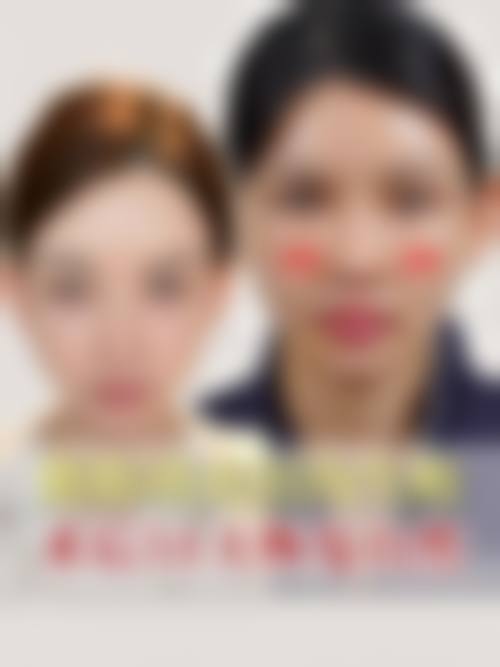 五、乌鲁木齐王焕梅整形医院实例
