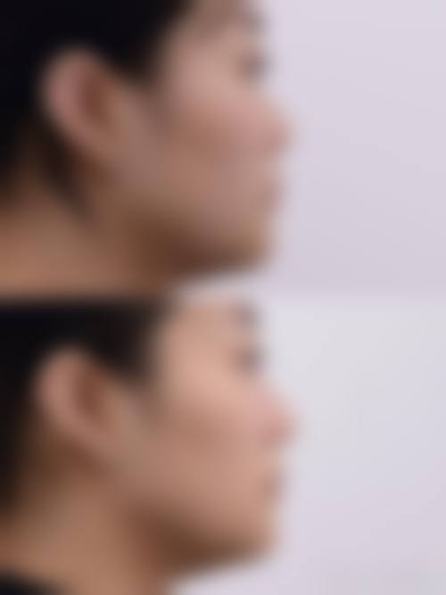 七、福州台江区米兰整形美容门诊部真实的顾客评价如下: