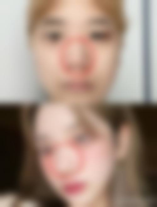 四、福州台江区米兰整形美容门诊部实例