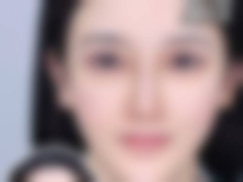 七、兴化焕智颜整形医院价格表:(仅供参考)