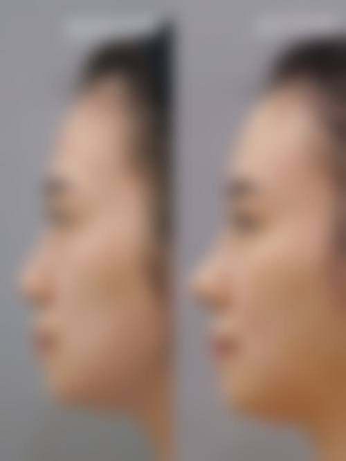 五、广州环尹整形外科门诊部实例