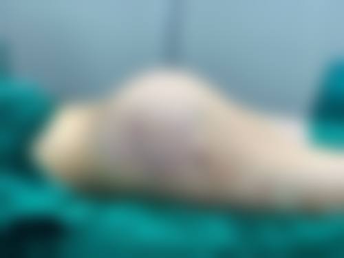 八、大庆皮肤病医院真实的顾客评价如下: