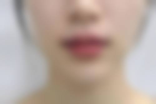 七、玉林市卫生学校附属医院整形科真实的顾客评价如下: