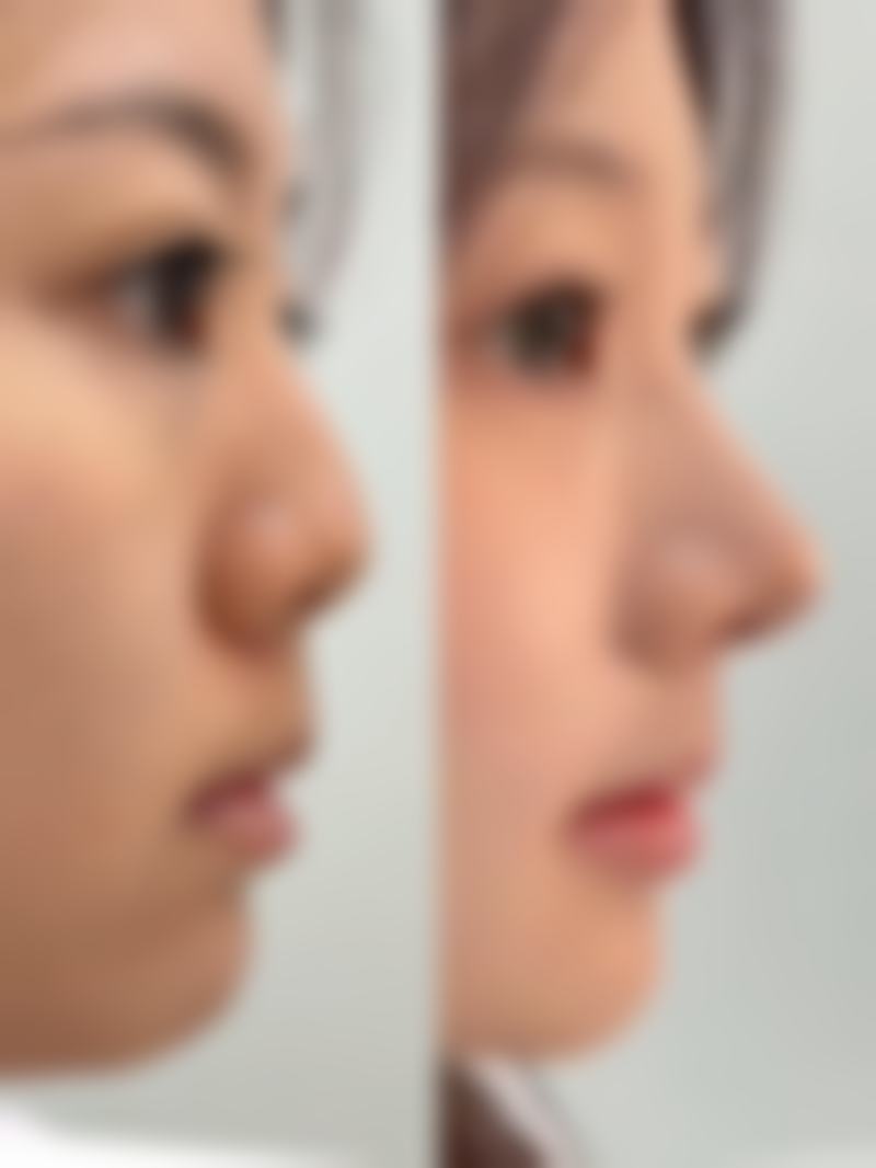 二、广州臻浠美整形医院正规吗?来看看医院资质: