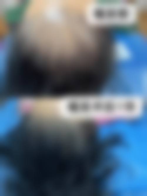 六、重庆迪邦皮肤医院毛发移植科怎么预约: