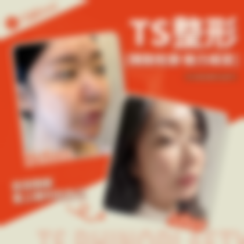 韩国TS整形医院的优势