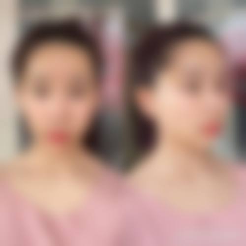 七、南海华美整形美容医院价格表:(仅供参考)