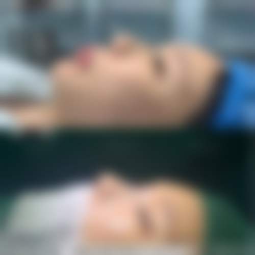 六、苏州昆山星容妍医疗美容门诊部怎么预约: