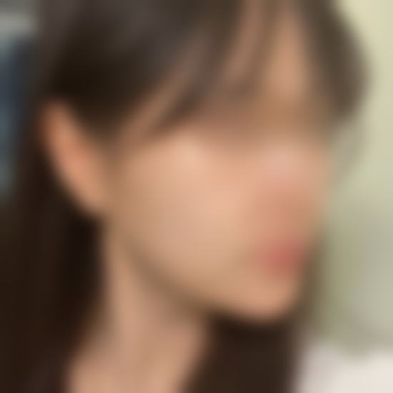 三、术后半年成效稳定,3万+换来的自然线条太值了