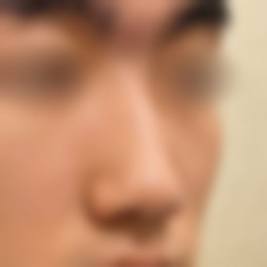 手术当天:紧张但踏实的流程