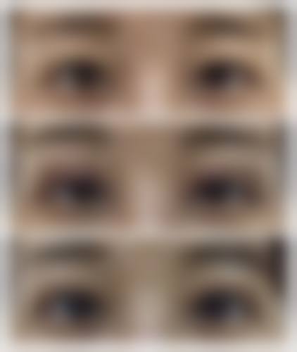 六、湖北荆州熙蒙医疗美容门诊部怎么预约:
