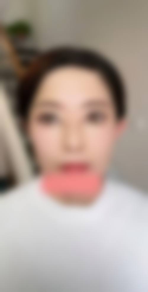 田丽梅医生在哪家医院怎么预约?