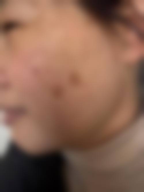 王晓刚医生实例